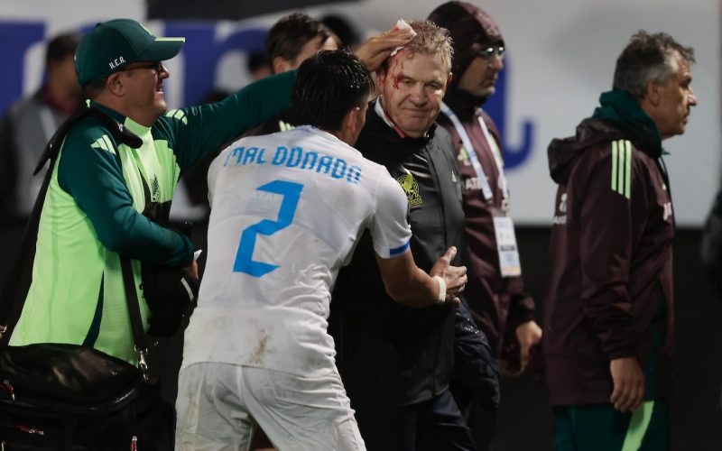 🎥 Vergogna in Honduras-Messico: il CT Aguirre colpito alla testa da una bottiglia