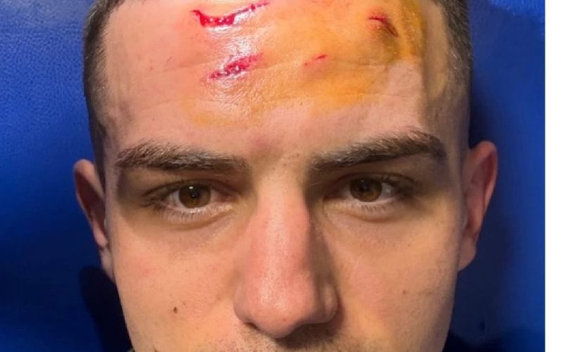 🤨 BVB polemico per il rigore qualificazione all’Atalanta: “Bensebaini non voleva colpire Krstovic”