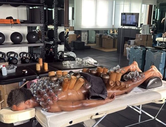 📸 Openda le prova TUTTE per riprendersi la Juve: marea di coppette sul corpo per accelerare il recupero! Di cosa si tratta 😅