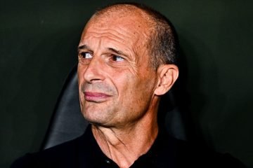 ⚠️ Allegri: “McTominay out? Problemi di vesciche. Serve più attenzione!”
